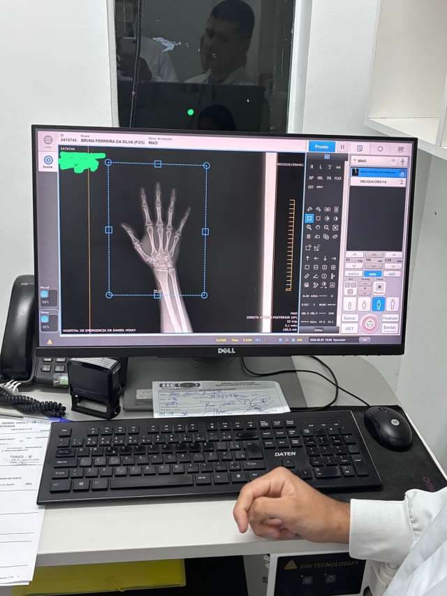 Grau