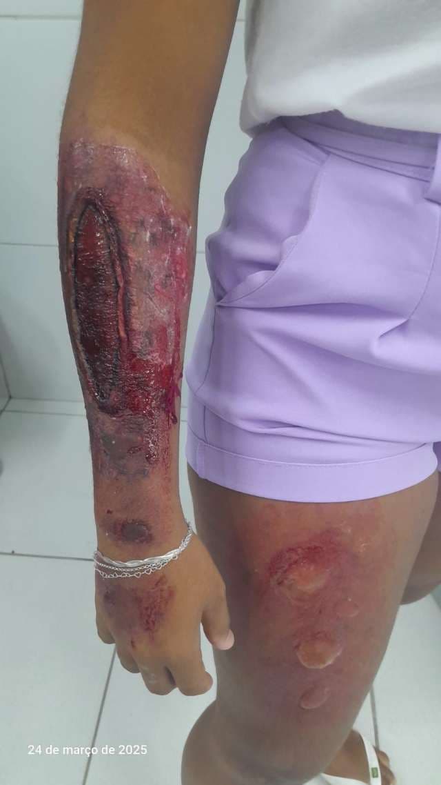 Grau